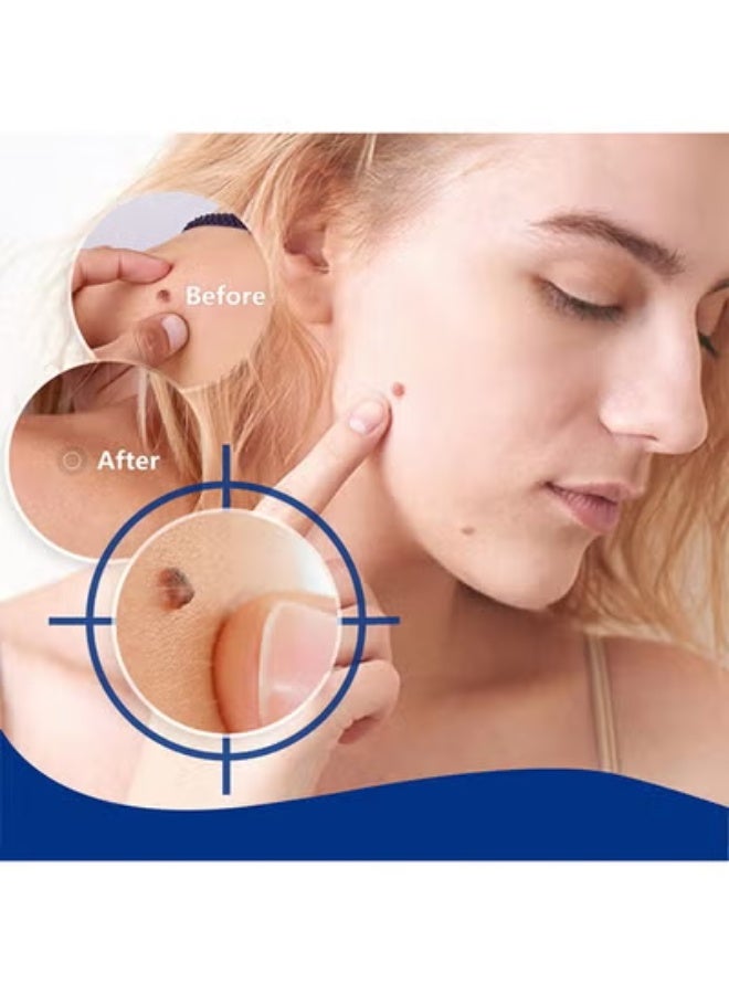 Sumifun Wart Remover Liquid, Maximum Strength Salicylic Acid Wart Liquid, One Step Invisible Wart Remover Strips, Fast-Acting Wart Liquid Freeze Off for Warts, Plantar Wart, Common Wart, Flat Wart 20ML - Image 5